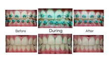 Cargar imagen en el visor de la galería, Plaque HD - Plaque Identifying Toothpaste (Mint) - Dr. Paul Williams
